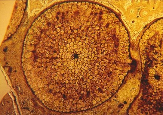 Transverse section of Rhynia