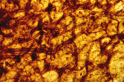 Hyphae of fungi in the Rhynie Chert